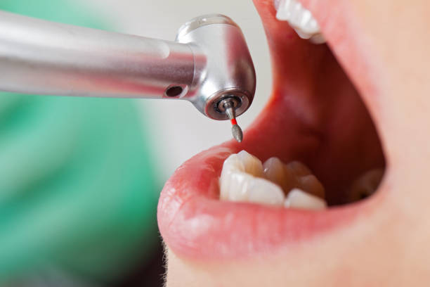 Best Chipped Tooth Repair Near Me  in Brewster, WA